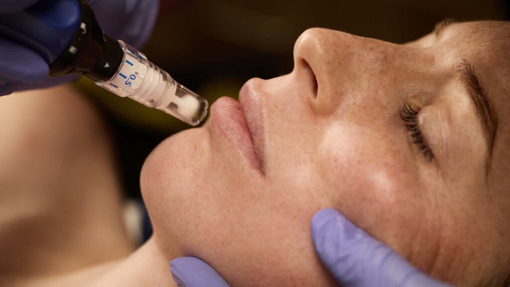 where to buy skinpen device